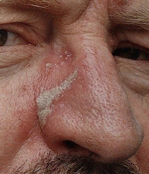 nose3_edited.jpg