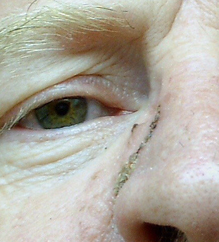 nose6_edited.jpg