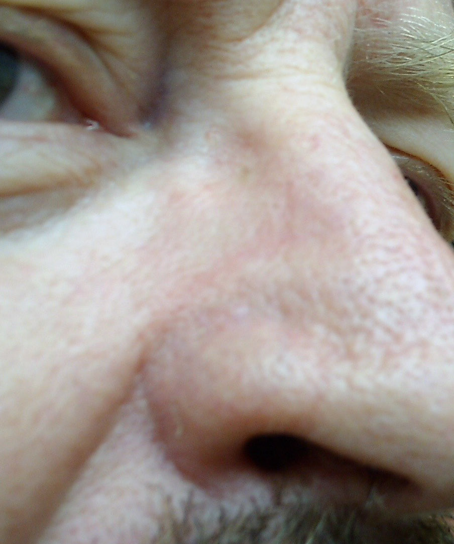 nose8_edited.jpg